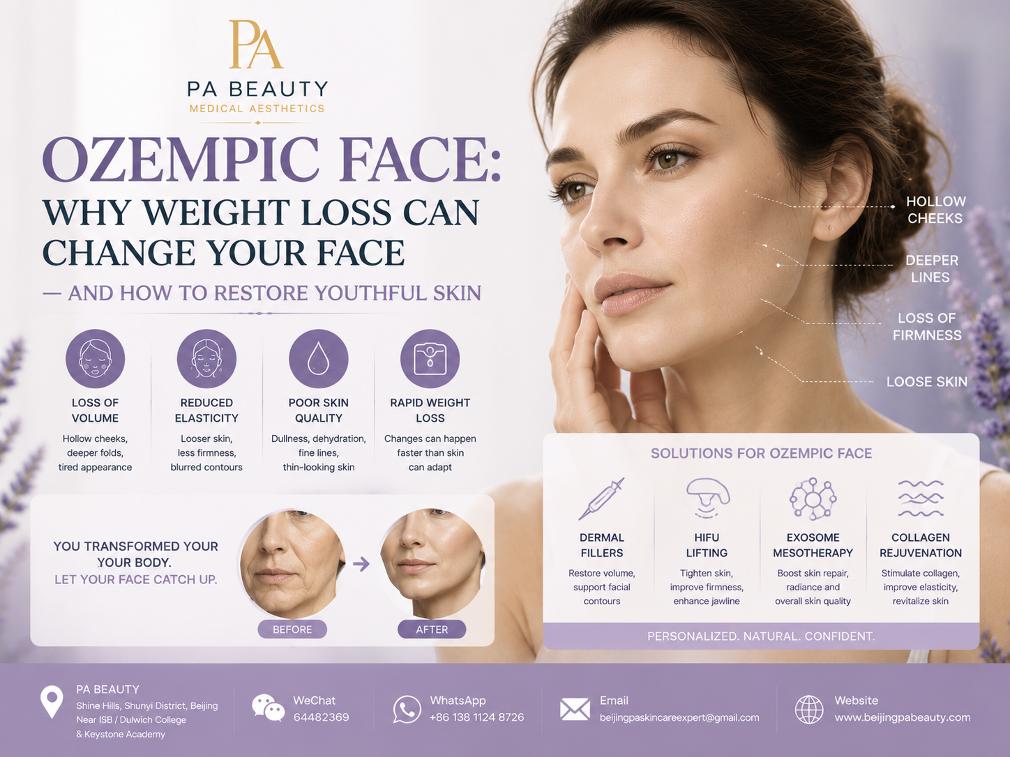 Ozempic Face: Why Weight Loss Changes Your Face & How to Restore Youthful Skin Ozempic Face: Why Weight Loss Changes Your Face & How to Restore Youthful Skin