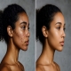  Acne & Dark Spots: Why Your "Anti-Acne" Routine Might Be Causing More Damage