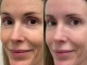 ​Face Rejuvenation day at PA BEAUTY