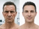 Botox for Men? Why Top Performers Choose It
