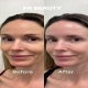 ​Face Rejuvenation day at PA BEAUTY