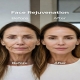 Finally tried Face Rejuvenation at PA BEAUTY in Beijing