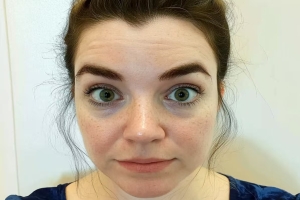 The Truth About Dark Circles: Why “Bad Sleep” Isn’t the Real Culprit (And How to Fix Them)