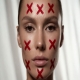 5 Signs You May Benefit from Botox in Beijing | PA BEAUTY