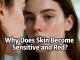 Why Skin Becomes Sensitive and Red?