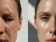 The "Botox Paradox": Why Starting Earlier Often Means Aging Better